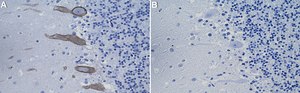 Anti-PKC&#947; Antibody, clone 2B9 ZooMAb&#174; Rabbit Monoclonal recombinant, expressed in HEK 293 cells