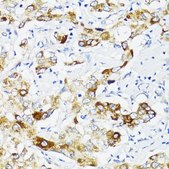 Anti-Fibronectin antibody produced in rabbit