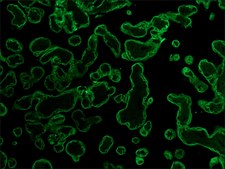 Monoclonal Anti-Cytokeratin, pan antibody produced in mouse clone PCK-26, ascites fluid