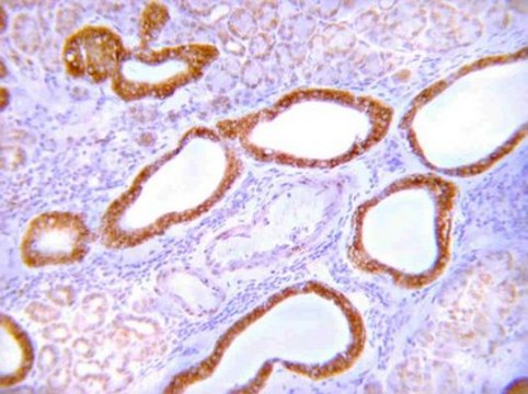 Anti-GLUT-4 Antibody, C-terminus from rabbit, purified by affinity chromatography