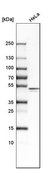 Anti-CASP9 antibody produced in rabbit Prestige Antibodies&#174; Powered by Atlas Antibodies, affinity isolated antibody, buffered aqueous glycerol solution