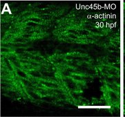 Monoclonal Anti-&#945;-Actinin (Sarcomeric) antibody produced in mouse clone EA-53, ascites fluid