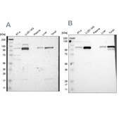 Anti-PRKCA antibody produced in rabbit Ab2, Prestige Antibodies&#174; Powered by Atlas Antibodies, affinity isolated antibody, buffered aqueous glycerol solution