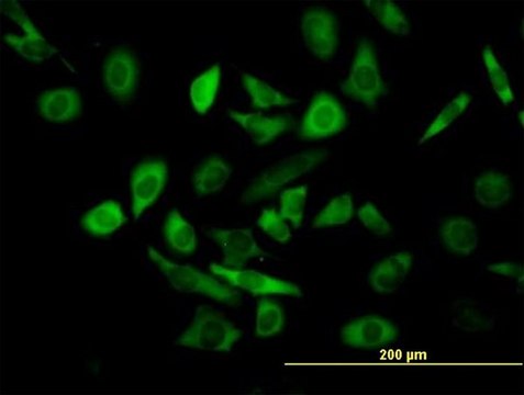 Anti-TRIM25 antibody produced in mouse purified immunoglobulin, buffered aqueous solution