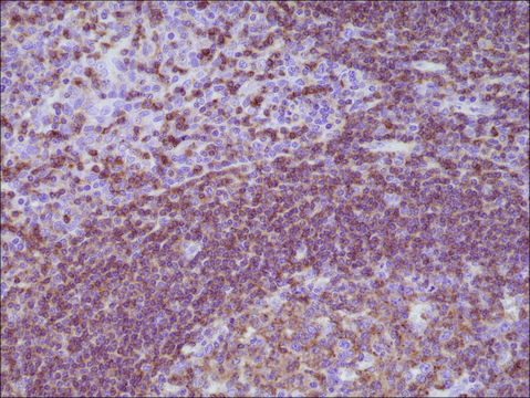 Anti-CD45 antibody, Rabbit Monoclonal recombinant, expressed in HEK 293 cells, clone RM291, purified immunoglobulin