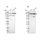 Anti-USP28 antibody produced in rabbit Ab2, Prestige Antibodies&#174; Powered by Atlas Antibodies, affinity isolated antibody, buffered aqueous glycerol solution