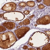 Anti-RAB43 antibody produced in rabbit Prestige Antibodies&#174; Powered by Atlas Antibodies, affinity isolated antibody, buffered aqueous glycerol solution