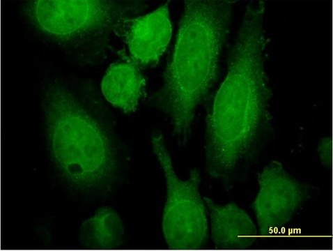 Monoclonal Anti-RAB3A antibody produced in mouse clone 4H7, purified immunoglobulin, buffered aqueous solution