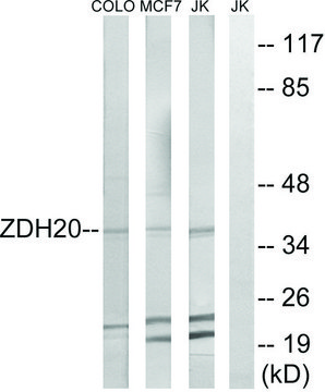 Anti-ZDHHC20 antibody produced in rabbit affinity isolated antibody