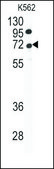 Anti-UBA2 (C-term A600) antibody produced in rabbit IgG fraction of antiserum, buffered aqueous solution