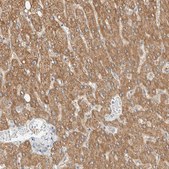 Anti-ALDH7A1 antibody produced in rabbit Prestige Antibodies&#174; Powered by Atlas Antibodies, affinity isolated antibody, buffered aqueous glycerol solution