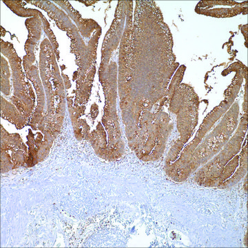 CEA Rabbit Polyclonal Antibody