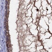 Anti-SERPINA3 antibody produced in rabbit Prestige Antibodies&#174; Powered by Atlas Antibodies, affinity isolated antibody, buffered aqueous glycerol solution
