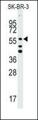 Anti-ALDH5A1 (N-term) antibody produced in rabbit affinity isolated antibody, buffered aqueous solution