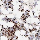 Anti-S100A12 antibody produced in rabbit Prestige Antibodies&#174; Powered by Atlas Antibodies, affinity isolated antibody, buffered aqueous glycerol solution