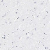 Anti-LTBP2 antibody produced in rabbit affinity isolated antibody, buffered aqueous glycerol solution