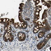 Anti-SELENOS antibody produced in rabbit affinity isolated antibody, buffered aqueous glycerol solution