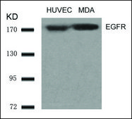 Anti-EGFR (Ab-1070) antibody produced in rabbit affinity isolated antibody