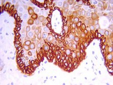 Anti-Cytokeratin 19 Antibody, clone RCK108 clone RCK108, Chemicon&#174;, from mouse