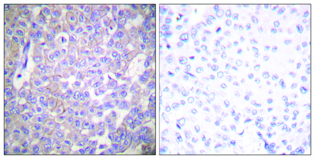 Anti-Claudin 2 antibody produced in rabbit affinity isolated antibody