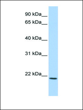 Anti-IL22 antibody produced in rabbit affinity isolated antibody