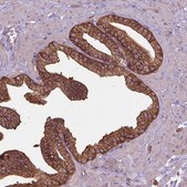 Anti-CORO1B antibody produced in rabbit Prestige Antibodies&#174; Powered by Atlas Antibodies, affinity isolated antibody, buffered aqueous glycerol solution