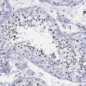 Anti-CCDC144A antibody produced in rabbit Prestige Antibodies&#174; Powered by Atlas Antibodies, affinity isolated antibody, buffered aqueous glycerol solution