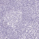 Anti-SLC5A2 antibody produced in rabbit Prestige Antibodies&#174; Powered by Atlas Antibodies, affinity isolated antibody, buffered aqueous glycerol solution
