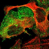 Anti-PDLIM2 antibody produced in rabbit Prestige Antibodies&#174; Powered by Atlas Antibodies, affinity isolated antibody, buffered aqueous glycerol solution