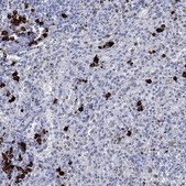 Anti-P2RY6 antibody produced in rabbit Prestige Antibodies&#174; Powered by Atlas Antibodies, affinity isolated antibody, buffered aqueous glycerol solution