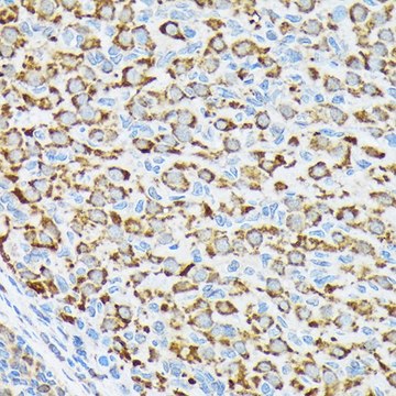Anti-p70 S6 Kinase 2 antibody produced in rabbit