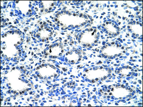 Anti-SMARCD2 antibody produced in rabbit affinity isolated antibody