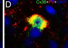 Monoclonal Anti-Parvalbumin antibody produced in mouse clone PARV-19, ascites fluid