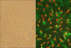 Human Cardiac Fibroblasts, Ventricle, Adult (5x10^5)