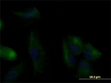 Monoclonal Anti-KRT20 antibody produced in mouse clone 2G3-1C8, purified immunoglobulin, buffered aqueous solution