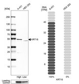 Anti-KRT15 antibody produced in rabbit Prestige Antibodies&#174; Powered by Atlas Antibodies, affinity isolated antibody, buffered aqueous glycerol solution