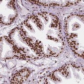 Anti-NUCKS1 antibody produced in rabbit Prestige Antibodies&#174; Powered by Atlas Antibodies, affinity isolated antibody, buffered aqueous glycerol solution
