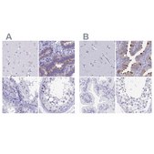 Anti-SNTN antibody produced in rabbit Prestige Antibodies&#174; Powered by Atlas Antibodies, affinity isolated antibody, buffered aqueous glycerol solution