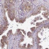 Anti-TIMMDC1 antibody produced in rabbit Prestige Antibodies&#174; Powered by Atlas Antibodies, affinity isolated antibody, buffered aqueous glycerol solution