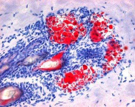 Oil red O staining solution for the detection of neutral lipids in cryo sections for microscopy