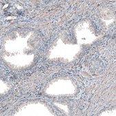 Anti-COL1A1 antibody produced in rabbit Prestige Antibodies&#174; Powered by Atlas Antibodies, affinity isolated antibody, buffered aqueous glycerol solution