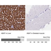 Anti-ABAT antibody produced in rabbit Prestige Antibodies&#174; Powered by Atlas Antibodies, affinity isolated antibody, buffered aqueous glycerol solution