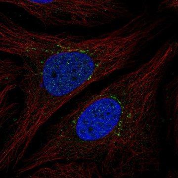 Anti-STEAP4 antibody produced in rabbit Prestige Antibodies&#174; Powered by Atlas Antibodies, affinity isolated antibody