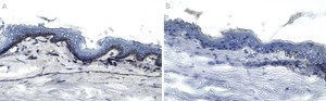 Anti-Collagen Type VII Antibody, clone 1E5 ZooMAb&#174; Rabbit Monoclonal recombinant, expressed in HEK 293 cells