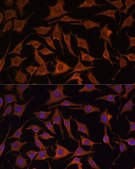 Anti-TNF-&#945; antibody produced in rabbit