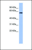 Anti-RBM47 antibody produced in rabbit affinity isolated antibody