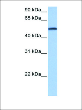 Anti-CYP1B1 affinity isolated antibody