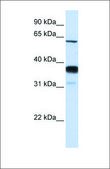 Anti-SMPD3 antibody produced in rabbit affinity isolated antibody