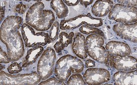 Anti-Spectrin &#945; Antibody, clone 2G17 ZooMAb&#174; Rabbit Monoclonal recombinant, expressed in HEK 293 cells