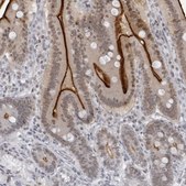 Anti-ESPN antibody produced in rabbit affinity isolated antibody, buffered aqueous glycerol solution